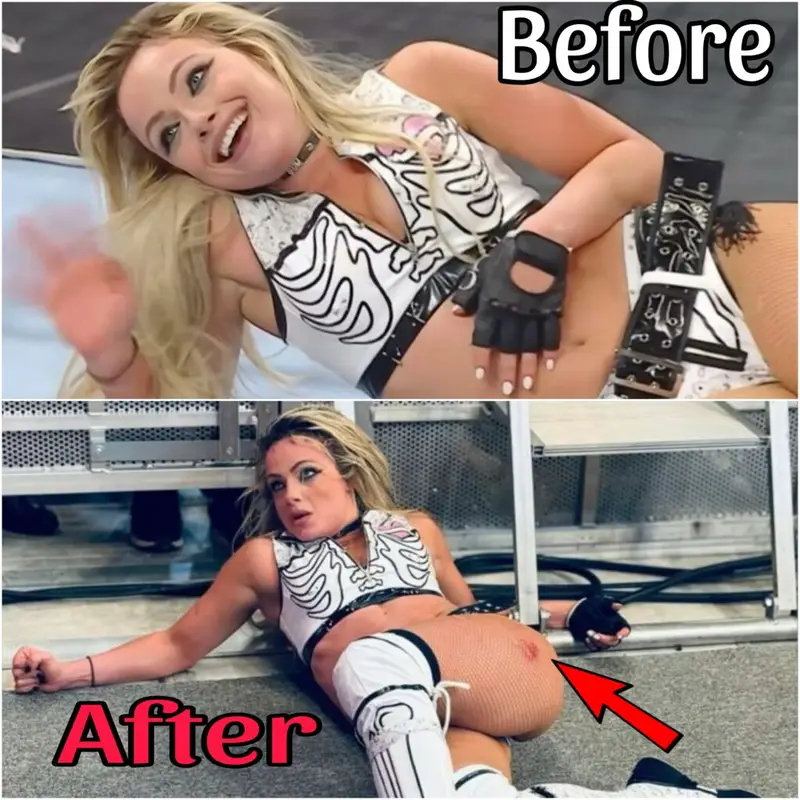 Liv Morgan breaks silence with brutal injury update following Elimination Chamber